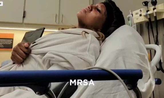 Atleta Contrai Superbactéria Que Corrói a Carne Após Entrar em Piscina de Hotel