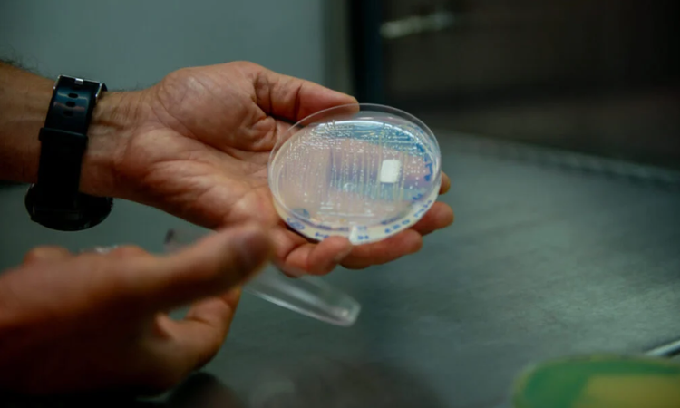 Saúde Pública: Sete pessoas são internadas em UTI após testarem positivo para superbactéria